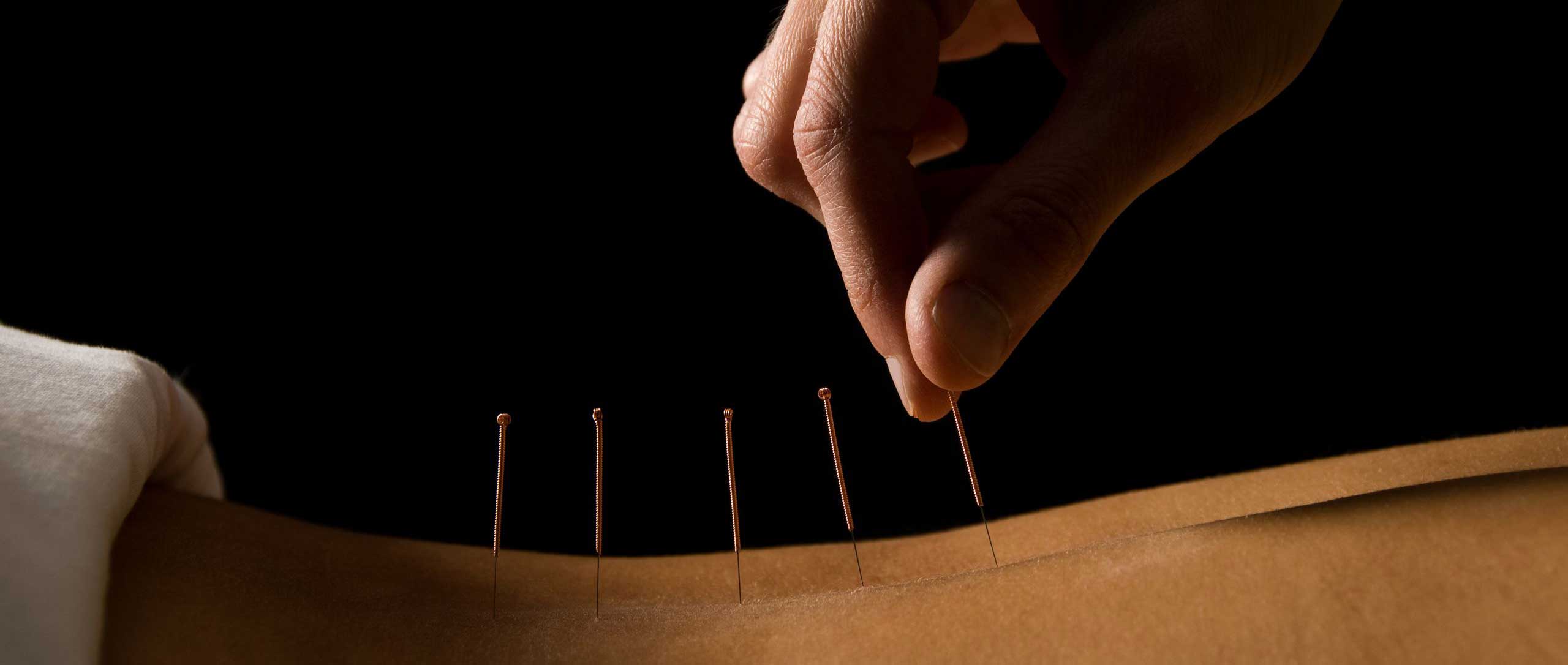 Praxis für Akupunktur Urban Nietlispach